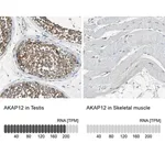 Merck Anti-AKAP12 antibody produced in rabbit
