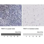 Merck Anti-TRAT1 antibody produced in rabbit