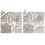 Merck ANTI-SUN1 antibody produced in rabbit
