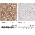 Merck Anti-ATP2B3 antibody produced in rabbit