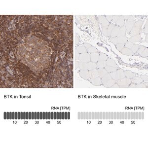 Merck Anti-BTK antibody produced in rabbit