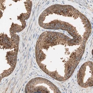 Merck Anti-USP2 antibody produced in rabbit