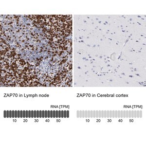 Merck Anti-ZAP70 antibody produced in rabbit