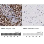 Merck Anti-ZAP70 antibody produced in rabbit