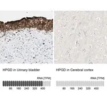 Merck Anti-HPGD antibody produced in rabbit
