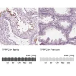Merck Anti-TPPP2 antibody produced in rabbit