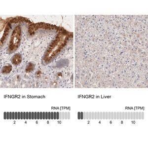 Merck Anti-IFNGR2 antibody produced in rabbit