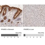 Merck Anti-IFNGR2 antibody produced in rabbit