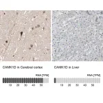 Merck Anti-CAMK1D antibody produced in rabbit