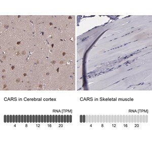 Merck Anti-CARS antibody produced in rabbit