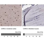 Merck Anti-CARS antibody produced in rabbit