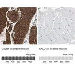 Merck Anti-CALD1 antibody produced in rabbit