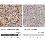 Merck Anti-ZNF133 antibody produced in rabbit