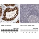 Merck Anti-KIAA1210 antibody produced in rabbit