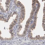 Merck Anti-RBM23 antibody produced in rabbit
