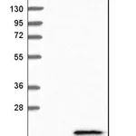 Merck Anti-C2orf40 antibody produced in rabbit