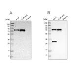 Merck Anti-MTDH antibody produced in rabbit