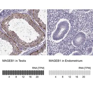 Merck ANTI-MAGEB1 antibody produced in rabbit