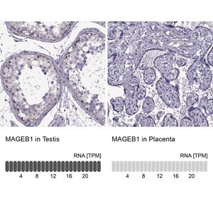 Merck ANTI-MAGEB1 antibody produced in rabbit