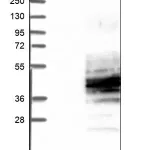Merck Anti-LTB4R antibody produced in rabbit