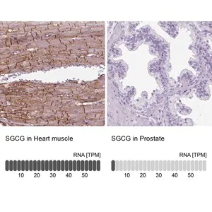 Merck Anti-SGCG antibody produced in rabbit