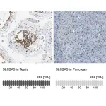 Merck Anti-SLC2A5 antibody produced in rabbit
