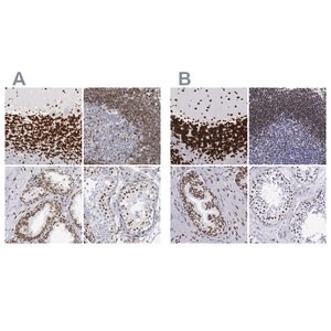Merck Anti-MECP2 antibody produced in rabbit