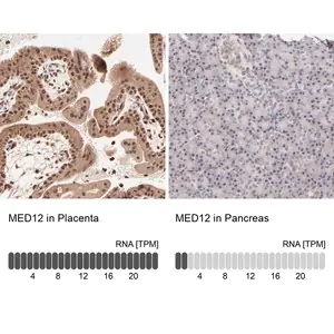 Merck Anti-MED12 antibody produced in rabbit