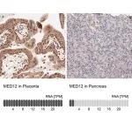 Merck Anti-MED12 antibody produced in rabbit
