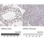 Merck Anti-MORC2 antibody produced in rabbit