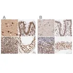 Merck Anti-MED12 antibody produced in rabbit