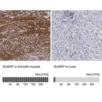 Merck Anti-SLMAP antibody produced in rabbit