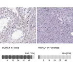 Merck Anti-MORC4 antibody produced in rabbit