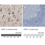 Merck Anti-SORT1 antibody produced in rabbit