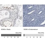 Merck Anti-SOX6 antibody produced in rabbit