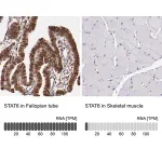 Merck Anti-STAT6 antibody produced in rabbit