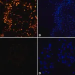Merck Anti-MNK2 (N-terminal) antibody produced in rabbit