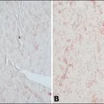 Merck Anti-Glutamic Acid Decarboxylase 65 (5-22) antibody produced in rabbit