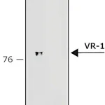 Merck Anti-Vanilloid Receptor-1 antibody produced in rabbit