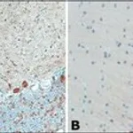 Merck Anti-Myosin Va (LE-16) antibody produced in rabbit