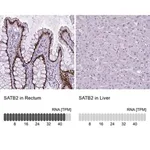 Merck Monoclonal Anti-SATB2 antibody produced in mouse