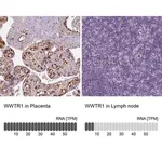 Merck Monoclonal Anti-WWTR1 antibody produced in mouse