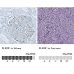 Merck Monoclonal Anti-PLA2R1 antibody produced in mouse
