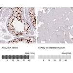 Merck Monoclonal Anti-ATAD2 antibody produced in mouse