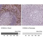 Merck Monoclonal Anti-S100A4 antibody produced in mouse