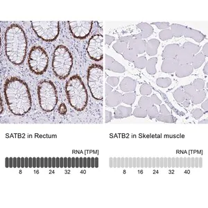 Merck Monoclonal Anti-SATB2 antibody produced in mouse