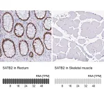 Merck Monoclonal Anti-SATB2 antibody produced in mouse