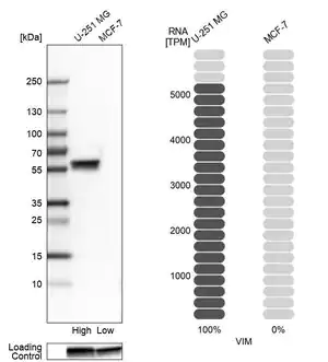 Merck Monoclonal Anti-VIM antibody produced in mouse