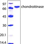 Merck Chondroitinase AC from Flavobacterium heparinum