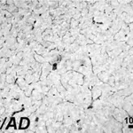 Merck Anti-Actin, α-Smooth Muscle antibody, Mouse monoclonal